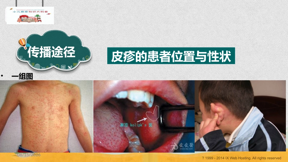 小儿麻疹科普_第5页