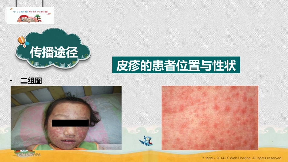 小儿麻疹科普_第6页