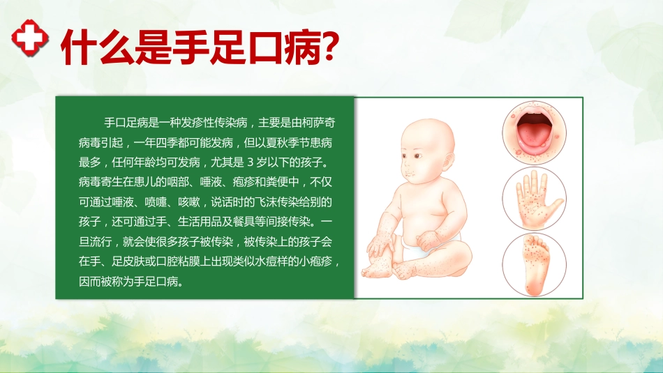 手足口病预防宣传教育PPT_第4页