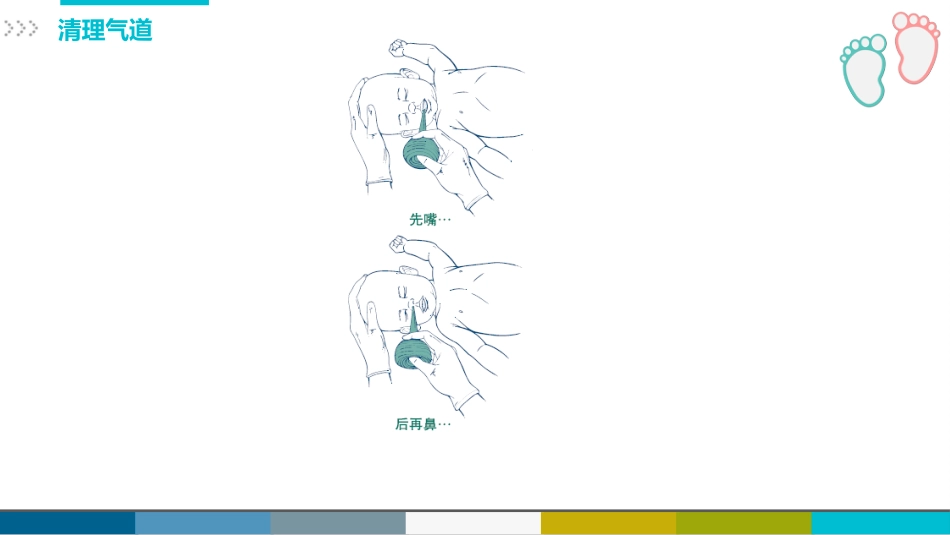 新生儿复苏CPR护理_第11页