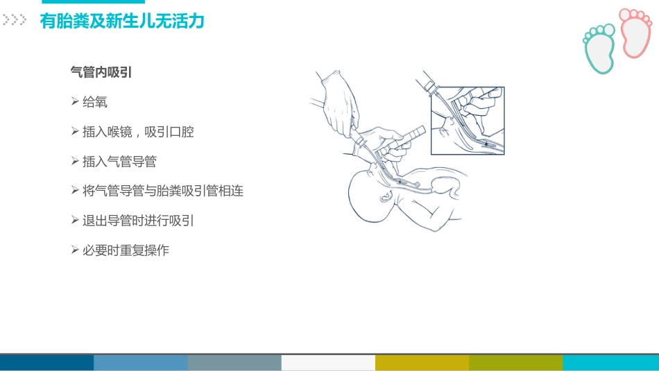新生儿复苏CPR护理_第14页