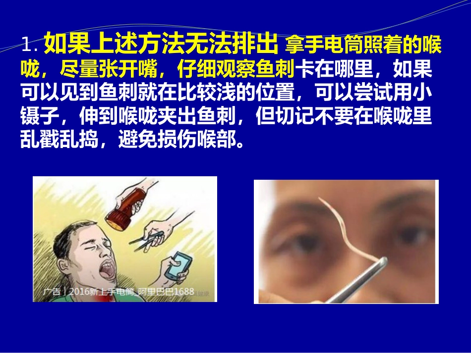 卡鱼刺了怎么办_第12页