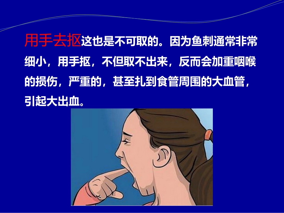 卡鱼刺了怎么办_第6页
