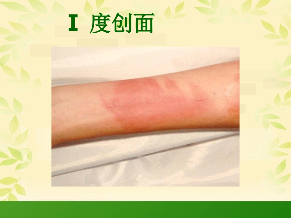 烧伤科普知识_第10页