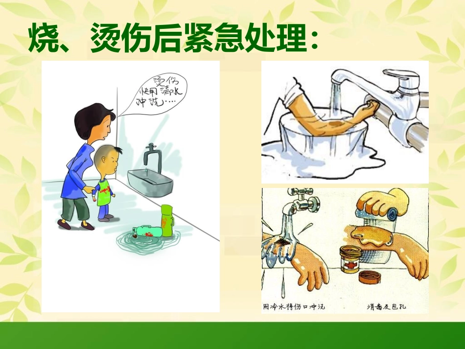 烧伤科普知识_第15页