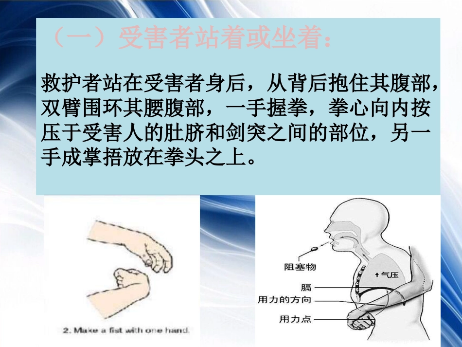 海姆立克急救法_第15页