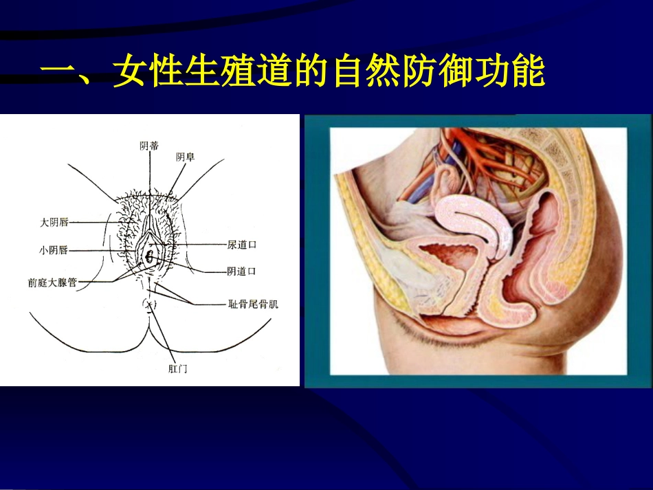 妇产科-盆腔炎_第4页