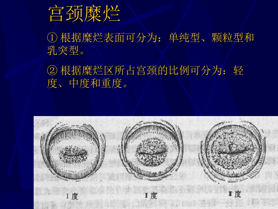 妇产科-盆腔炎宫颈炎_第8页