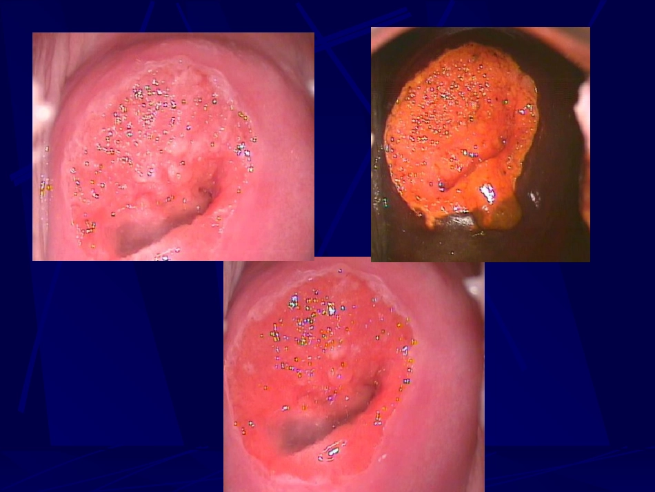 妇产科-盆腔炎宫颈炎_第9页