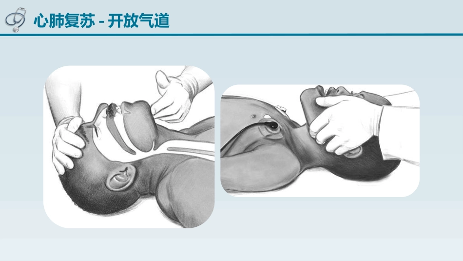 儿童心肺复苏_第10页