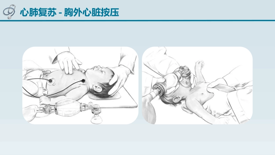 儿童心肺复苏_第8页
