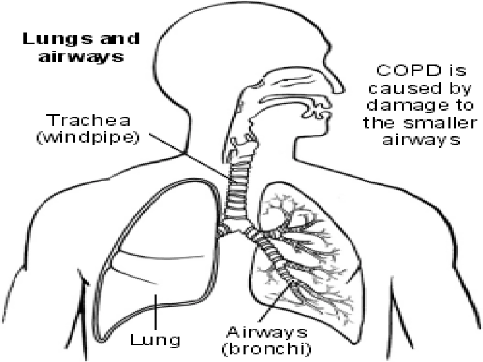 呼吸内科-COPD、慢性支气管炎_第4页