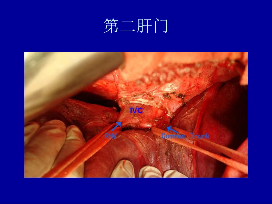 内科-肝脏疾病_第4页