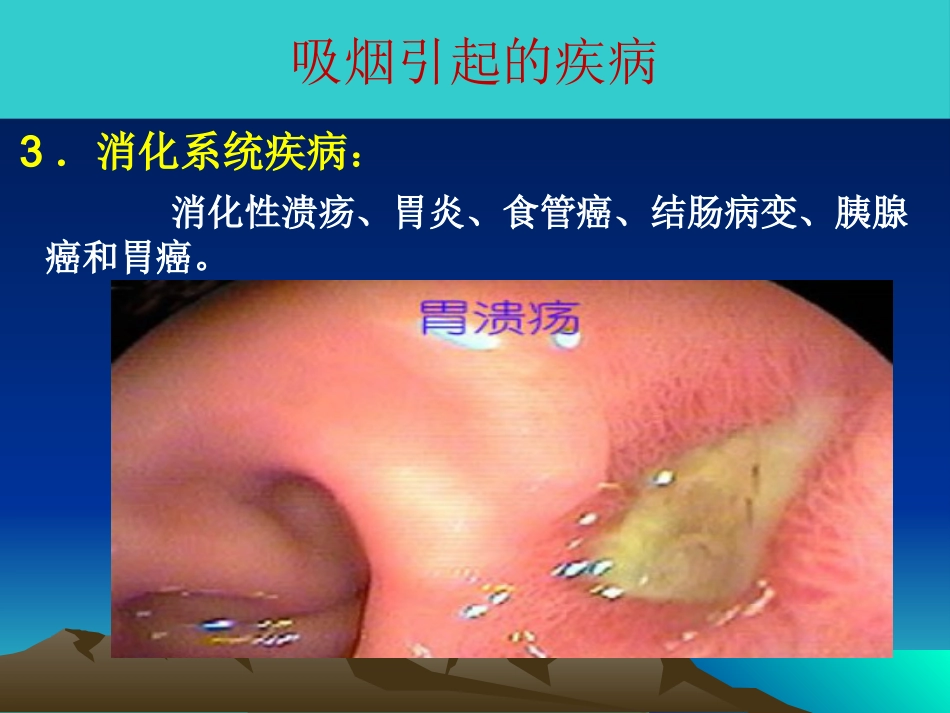 吸烟的危害及如何戒烟_第12页