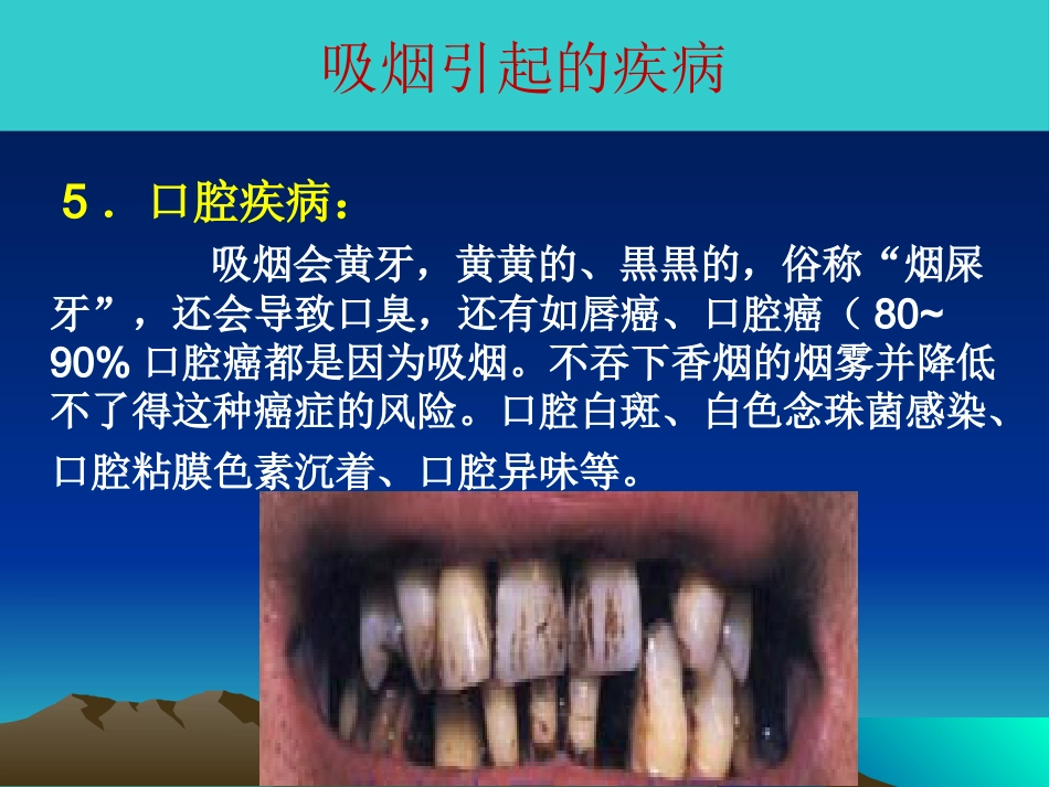吸烟的危害及如何戒烟_第14页