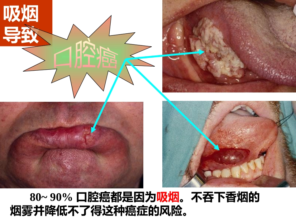 吸烟的危害及如何戒烟_第15页