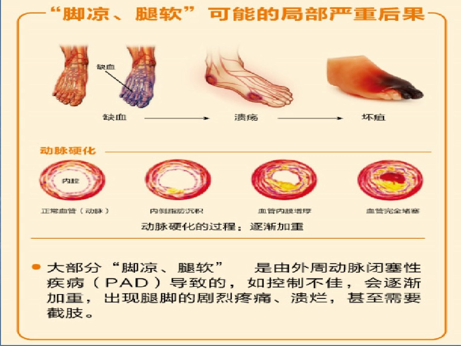 重视“脚凉”.“腿软”_第4页