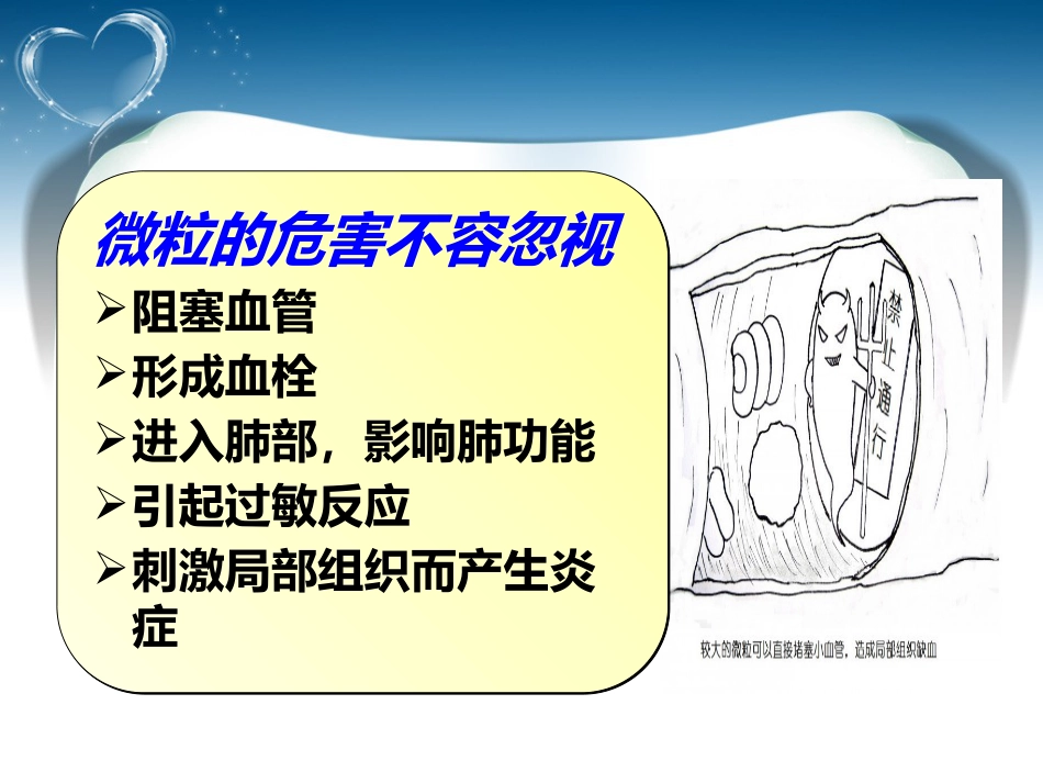 输液治疗安全吗_第13页
