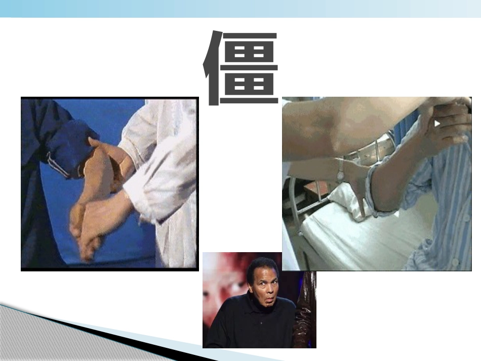 不怕帕金森病_第6页