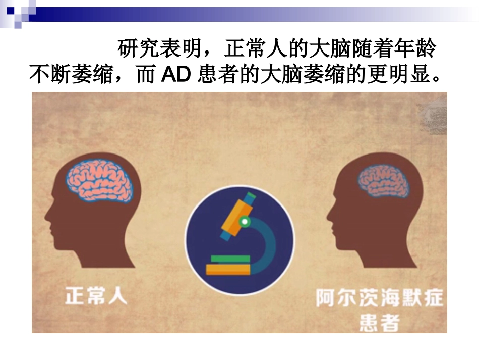 阿尔茨海默症_第6页