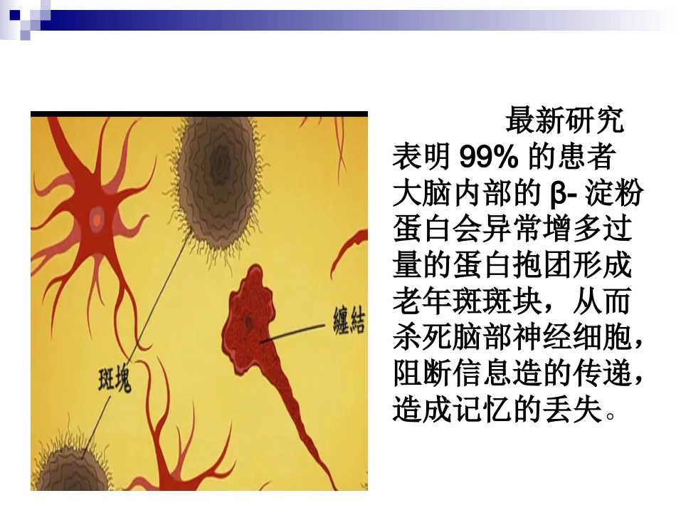 阿尔茨海默症_第7页
