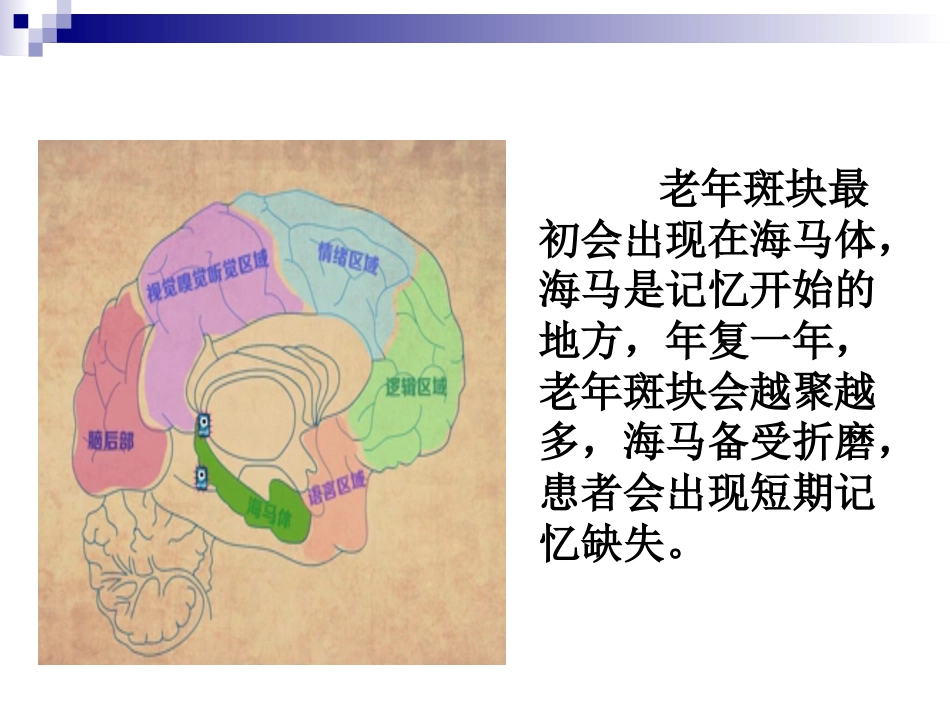 阿尔茨海默症_第8页