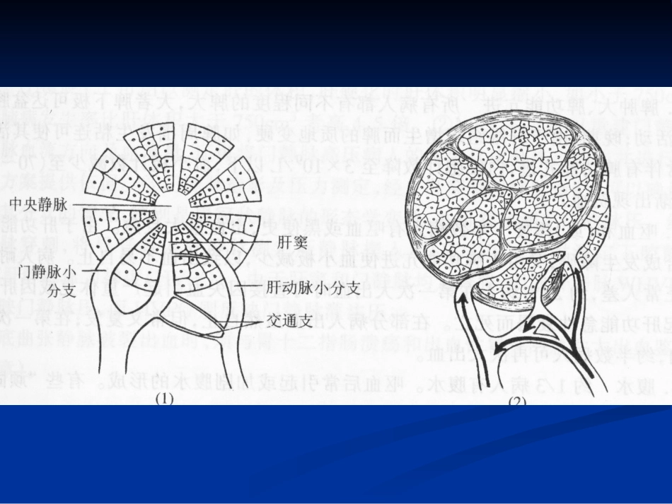 肝胆外科-门脉高压症（教学）_第10页