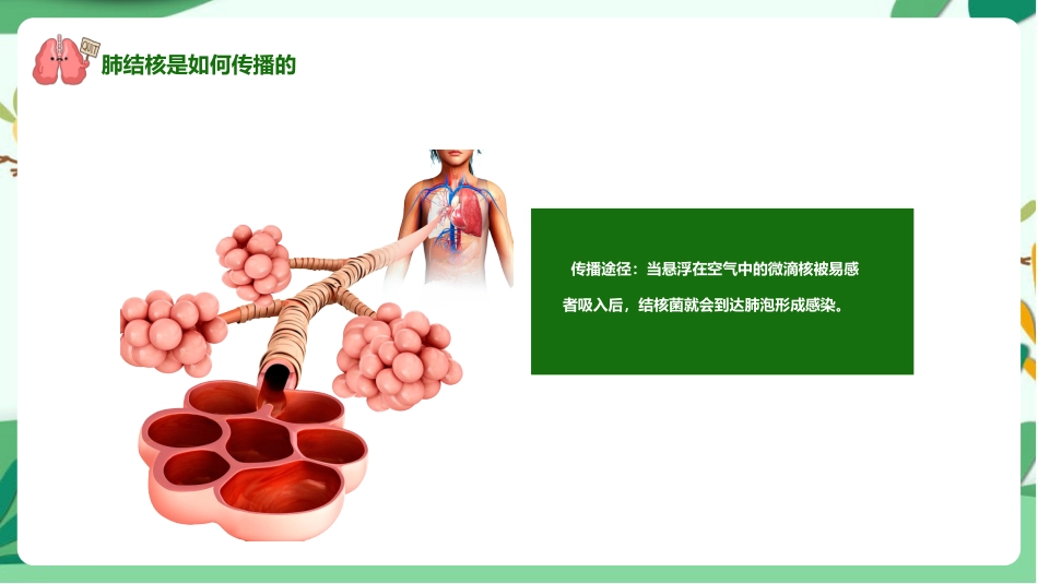 防治肺结核完整版ppt课件_第15页