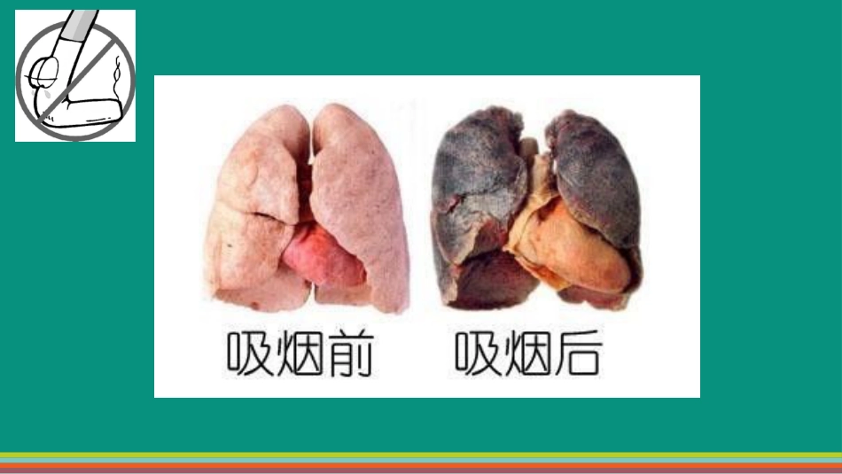 疾病预防从戒烟开始_第3页