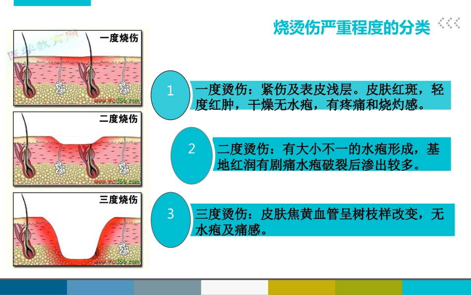 烧烫伤后的紧急处理_第3页