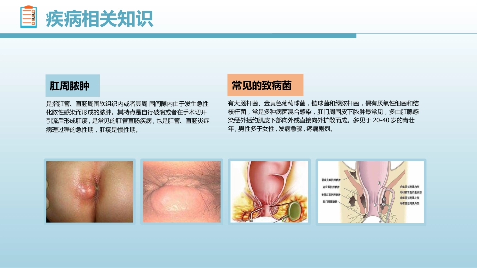 6肛肠科护理查房_第4页