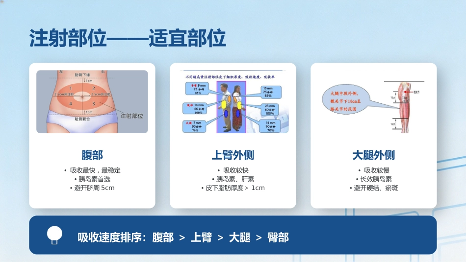 皮下注射操作规范_第13页