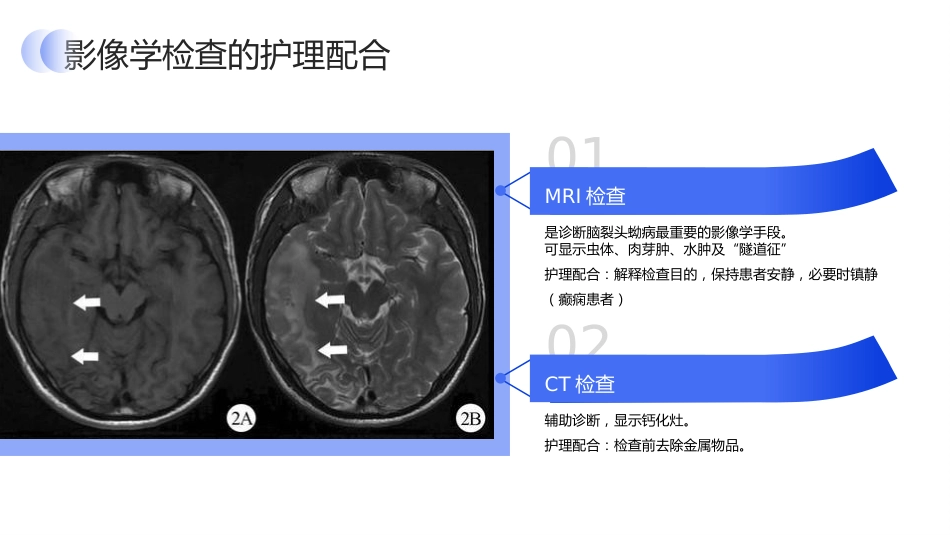 脑裂头蚴病护理查房_第15页