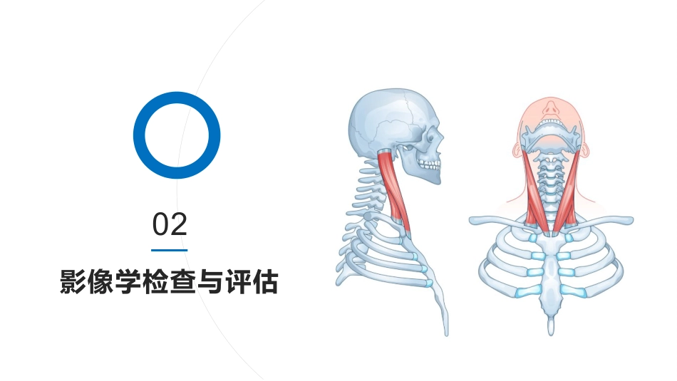寰枢椎脱位PPT_第7页