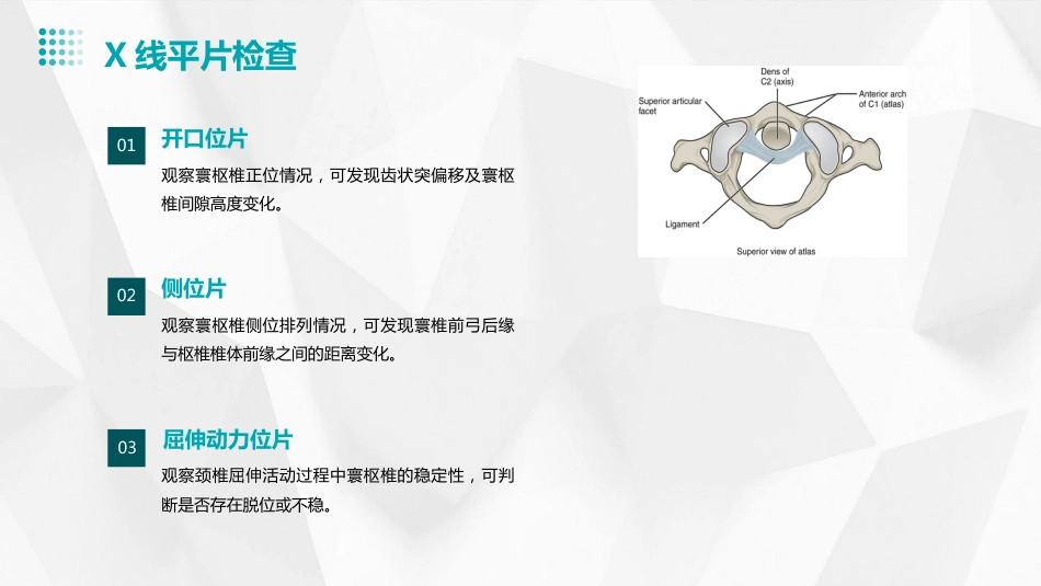 寰枢椎脱位PPT_第8页