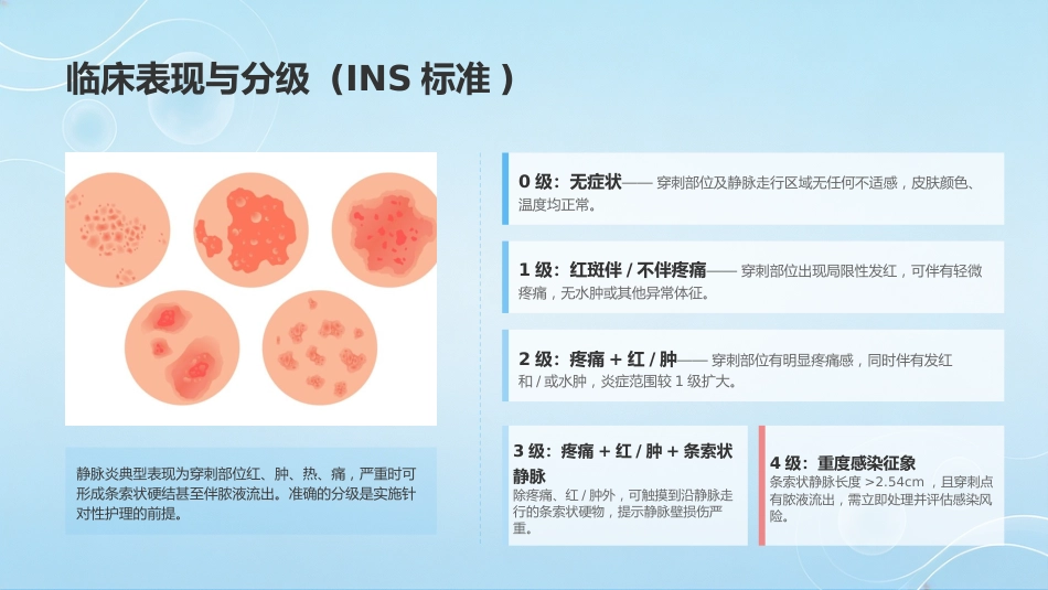 静脉输液所致静脉炎的预防及护理_第11页