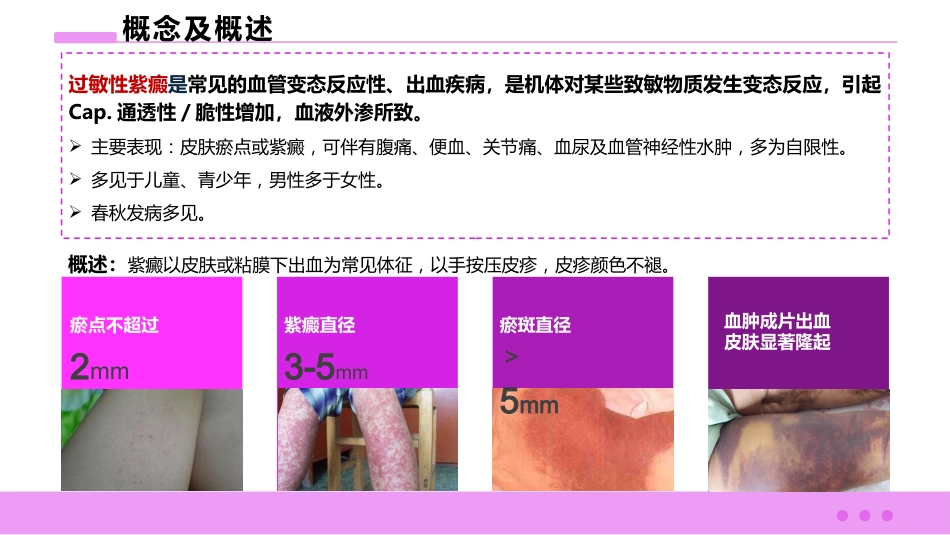 过敏性紫癜患者的护理_第3页