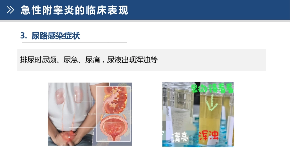 急性附睾炎的护理_第10页