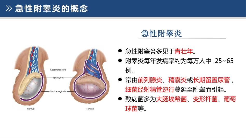 急性附睾炎的护理_第5页
