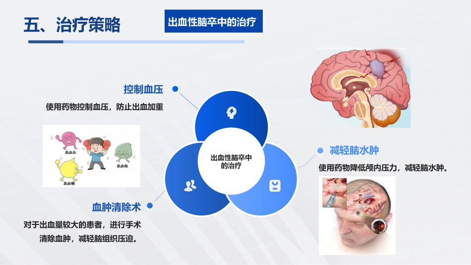 脑卒中知识普及宣教_第15页