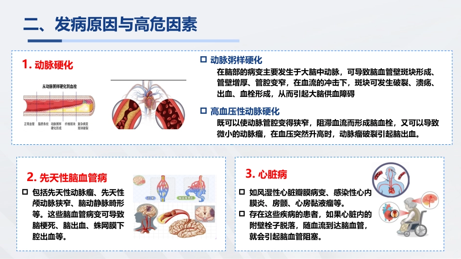脑卒中知识普及宣教_第4页