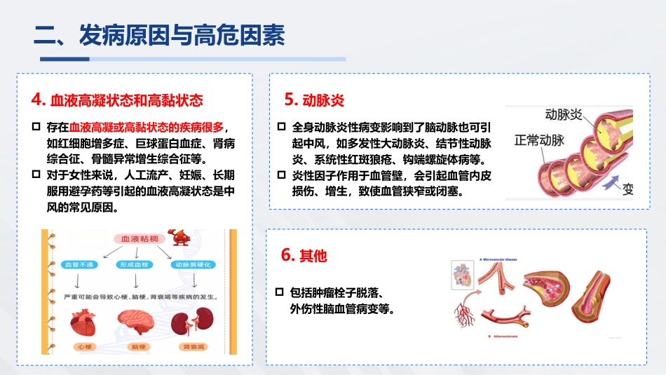 脑卒中知识普及宣教_第5页