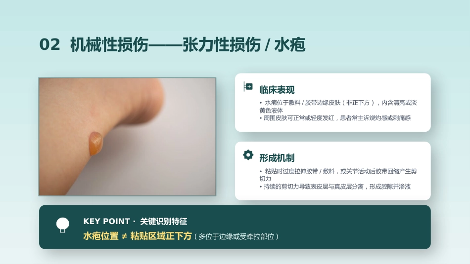 成人医用粘胶相关性皮肤损伤的预防及护理_第11页
