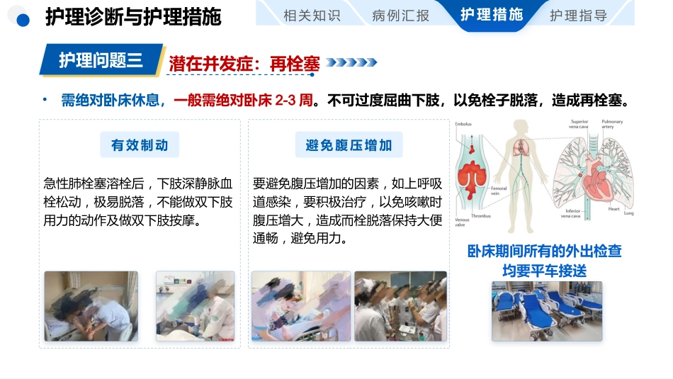 肺栓塞患者护理查房_第12页