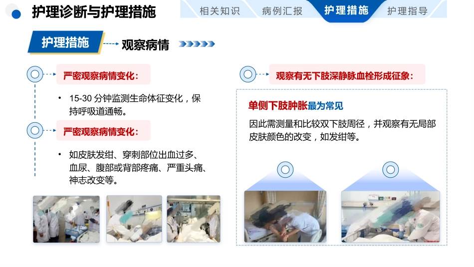 肺栓塞患者护理查房_第7页