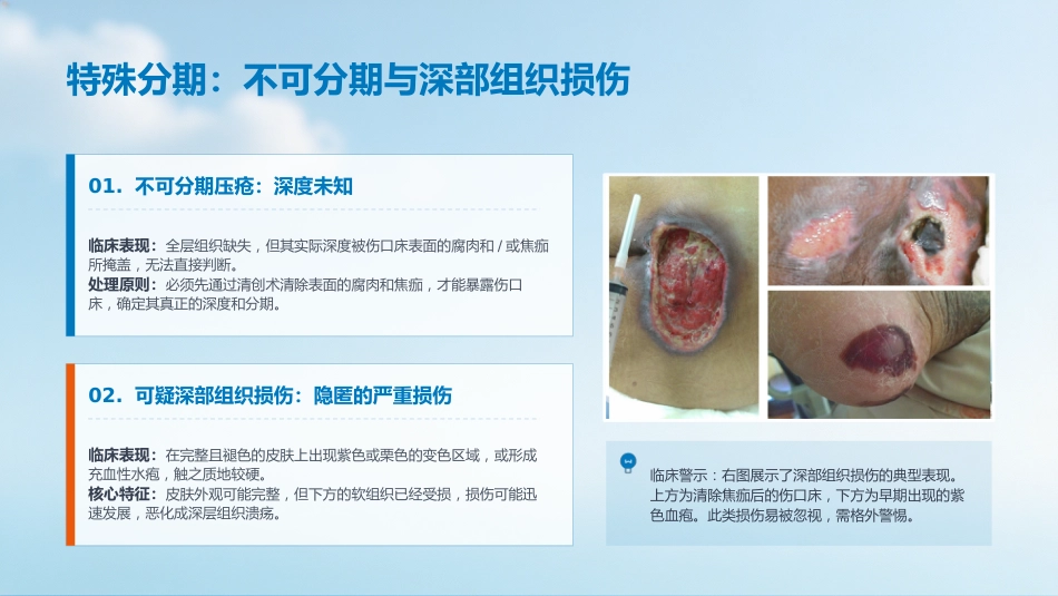 压疮的预防及护理_第10页