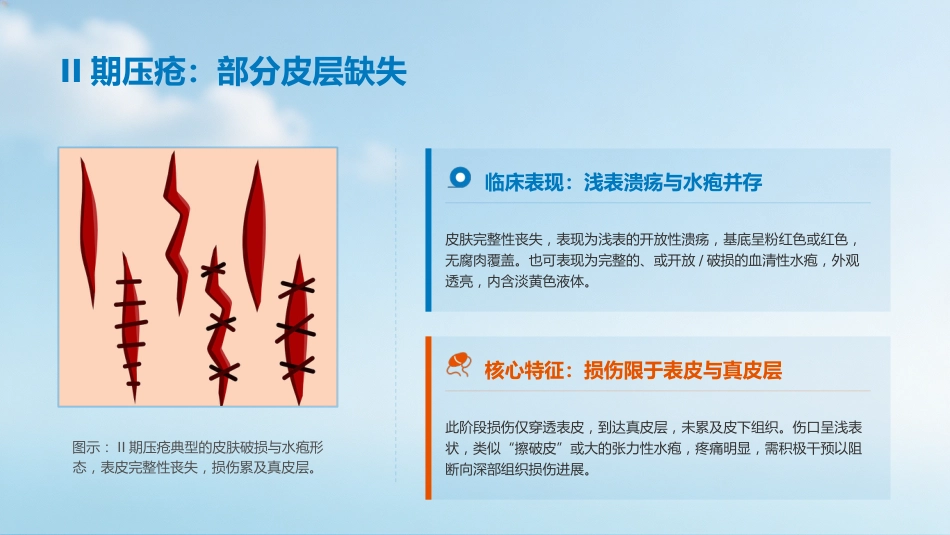 压疮的预防及护理_第7页