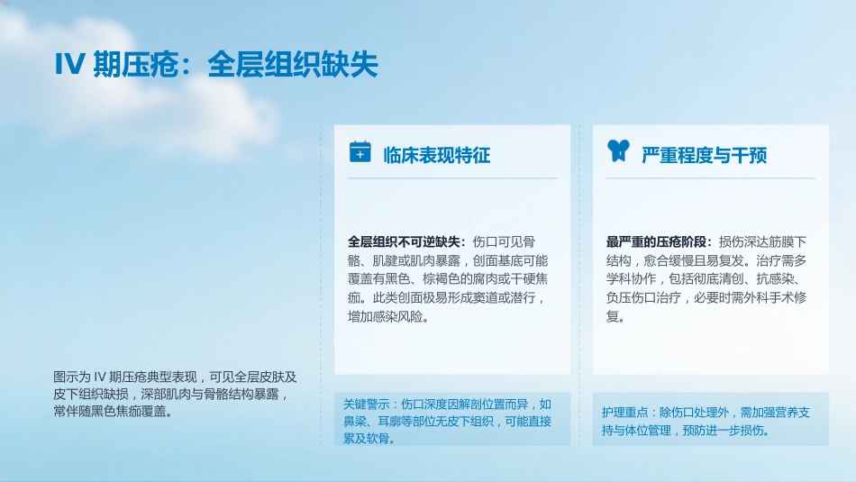 压疮的预防及护理_第9页