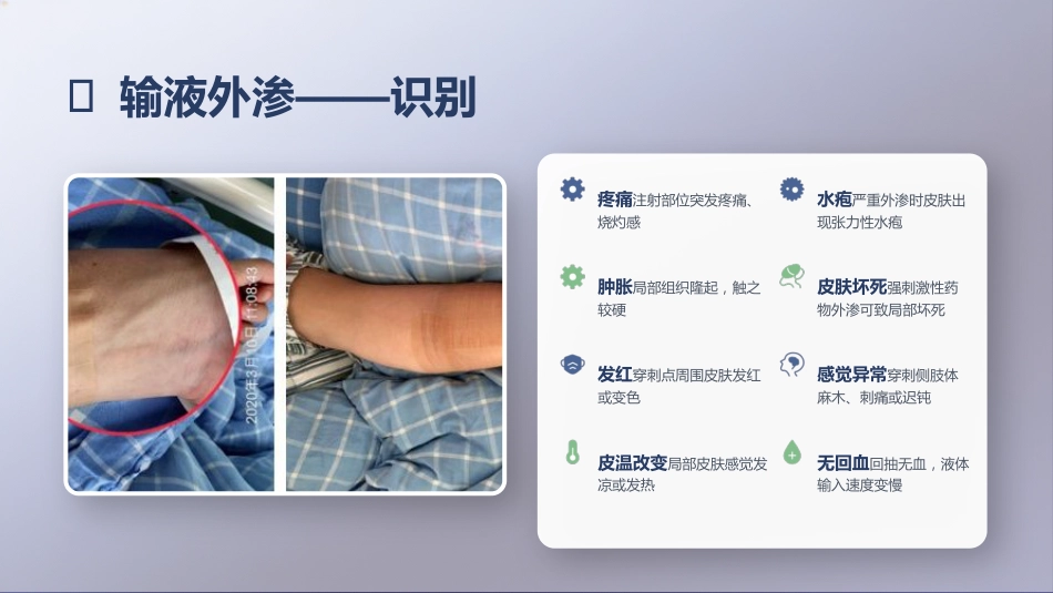 输液反应的识别与处理_第15页