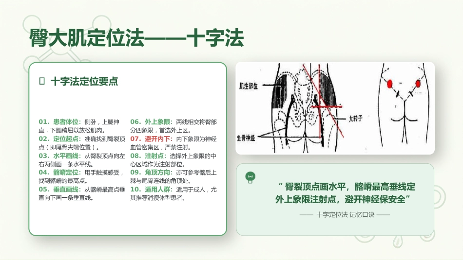 肌内注射定位技术与操作规范_第13页